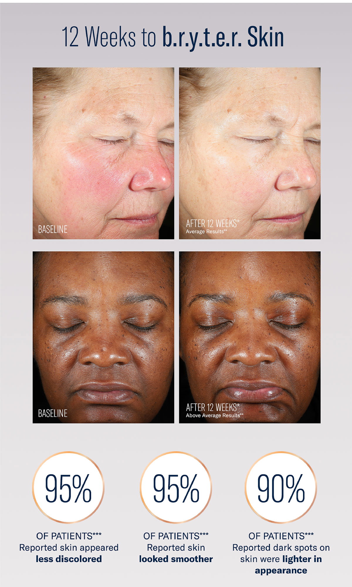 12 weeks to bryter skin