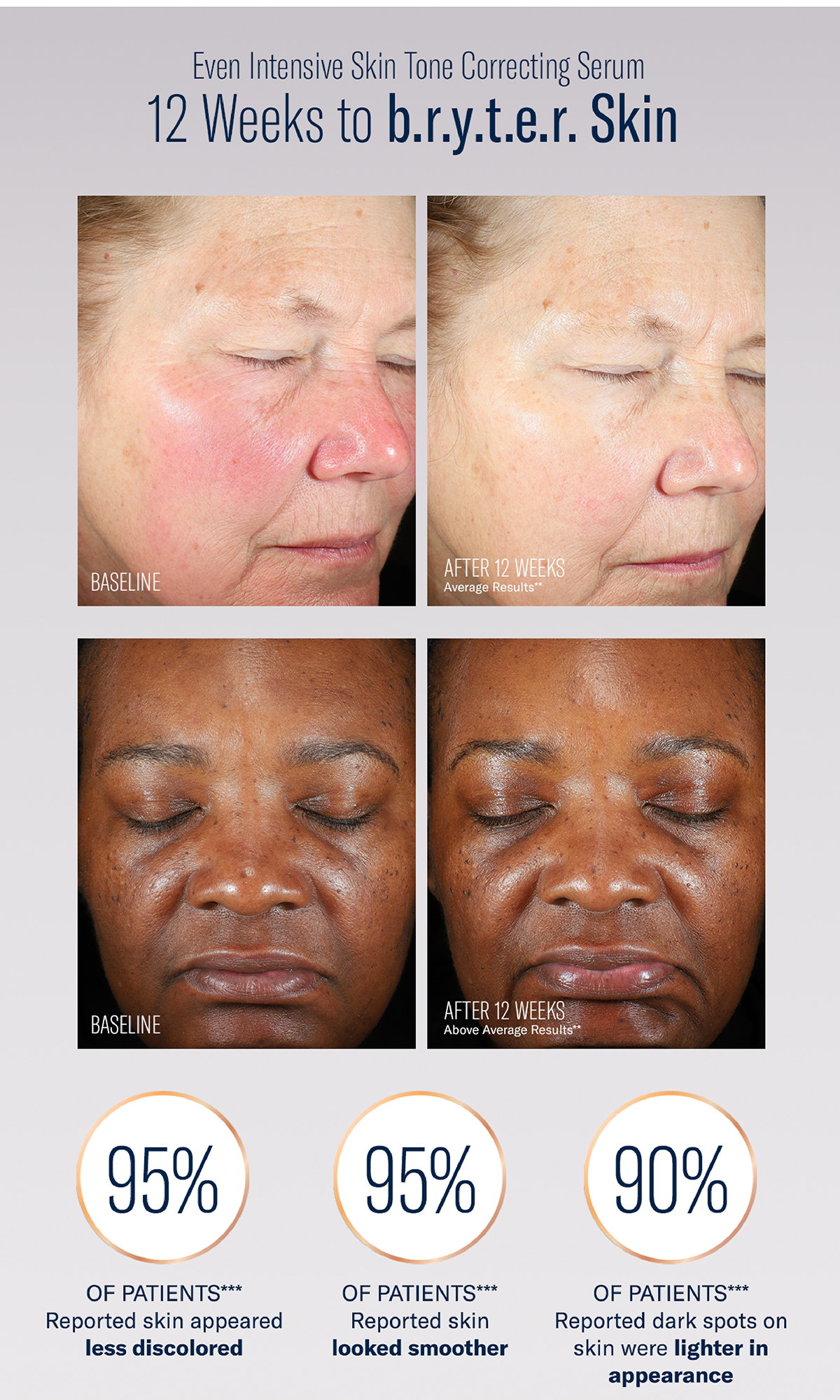 12 weeks to bryter skin