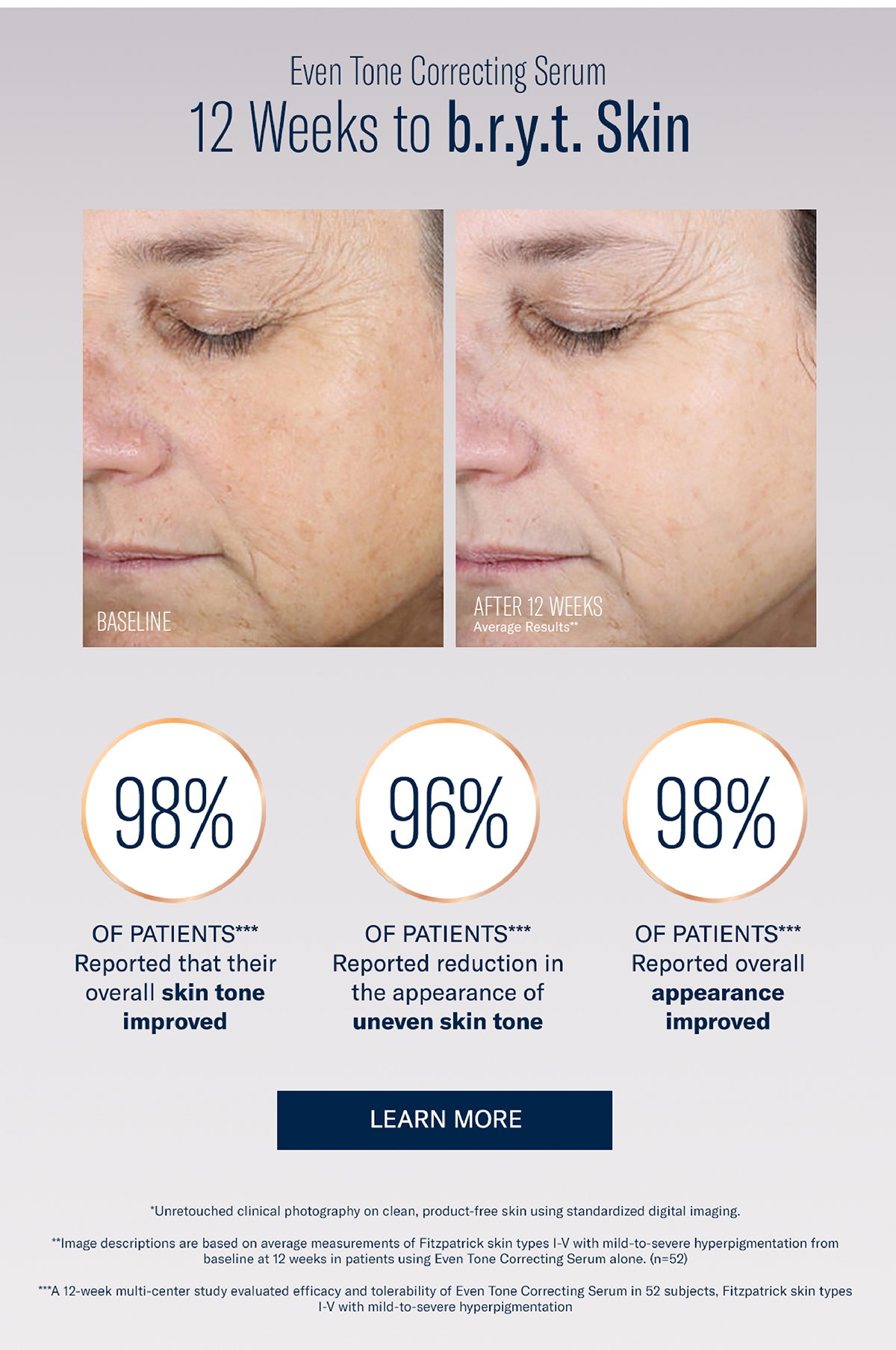 12 weeks to bryt skin