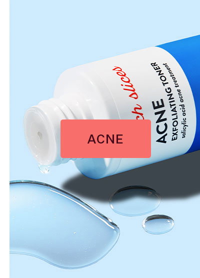 Acne