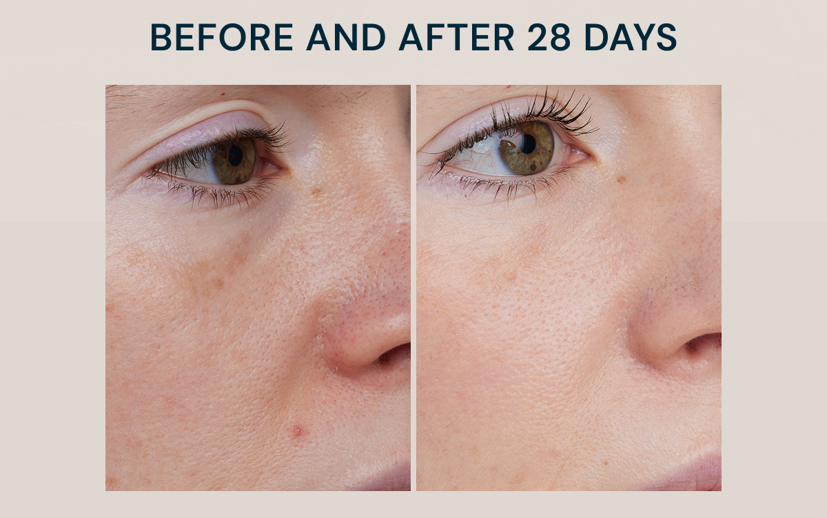 100% agree fine lines and wrinkles looked dramatically reduced^