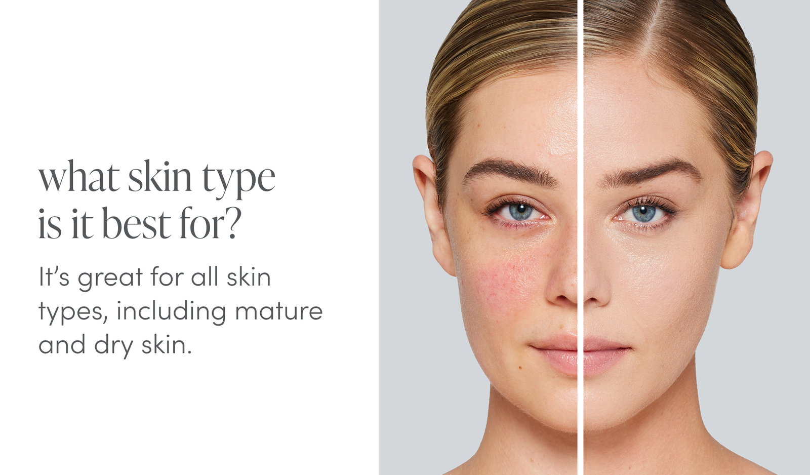 What skin type is it for? 