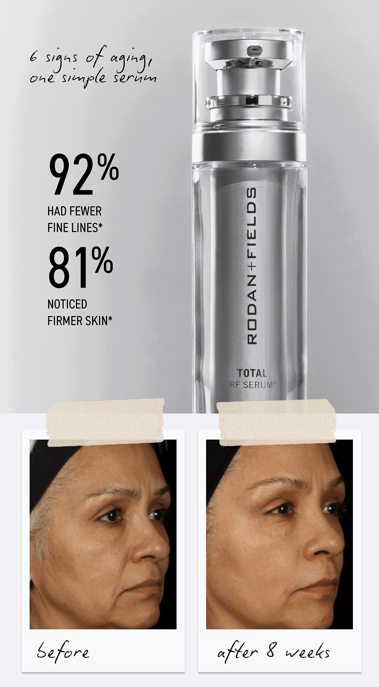 Results Are Already There, 6 Signs Of Aging, One Simple Serum. Here Are 8 Week Results.