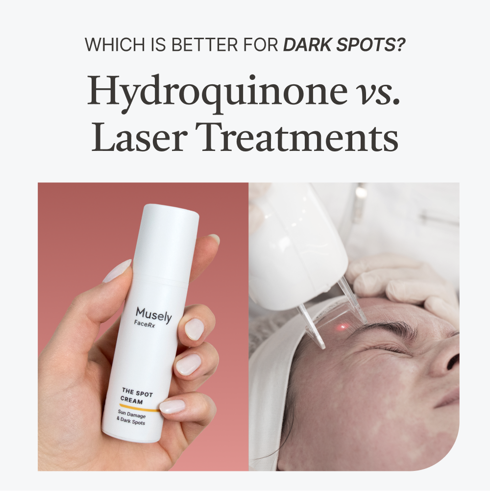Hydroquinone vs Laser Treatments - Which is better fpor