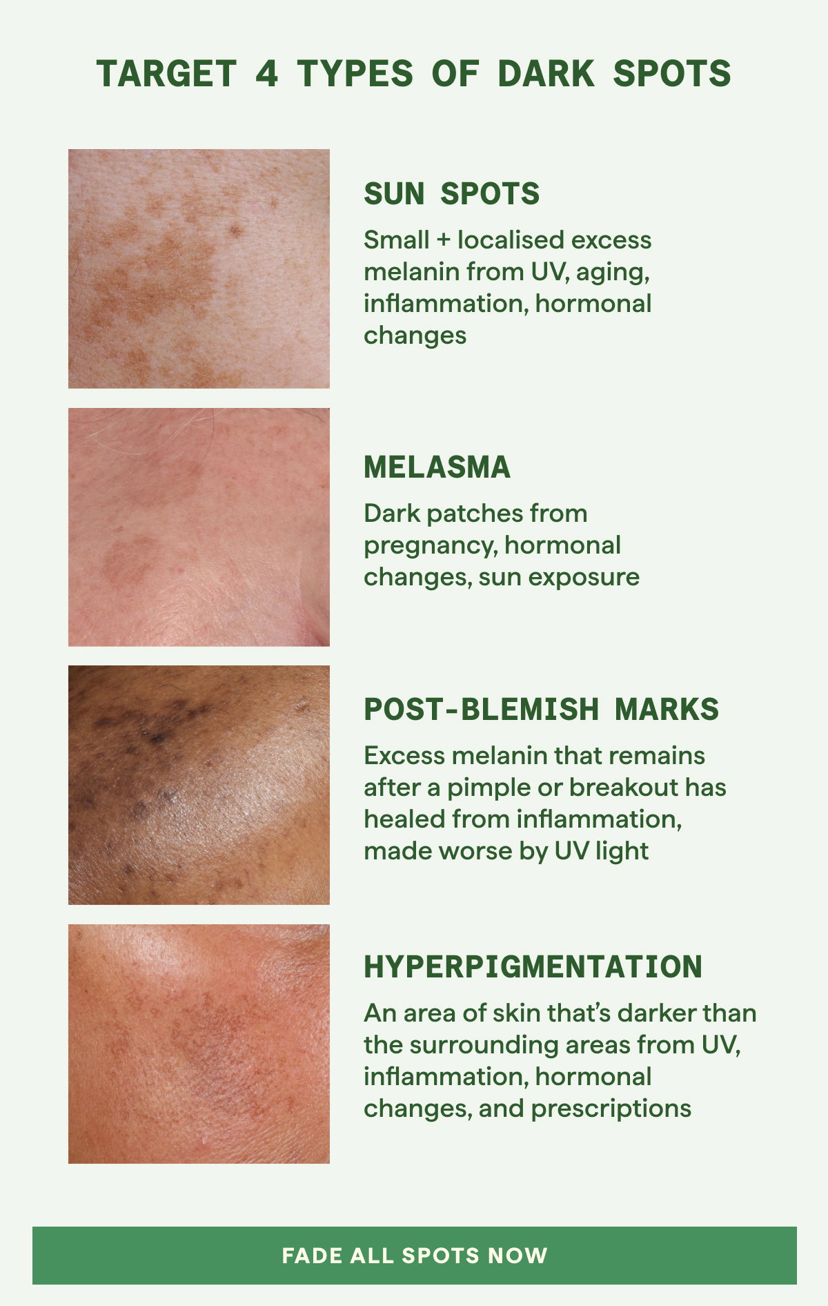 Four dark spots. One serum | Shop Now