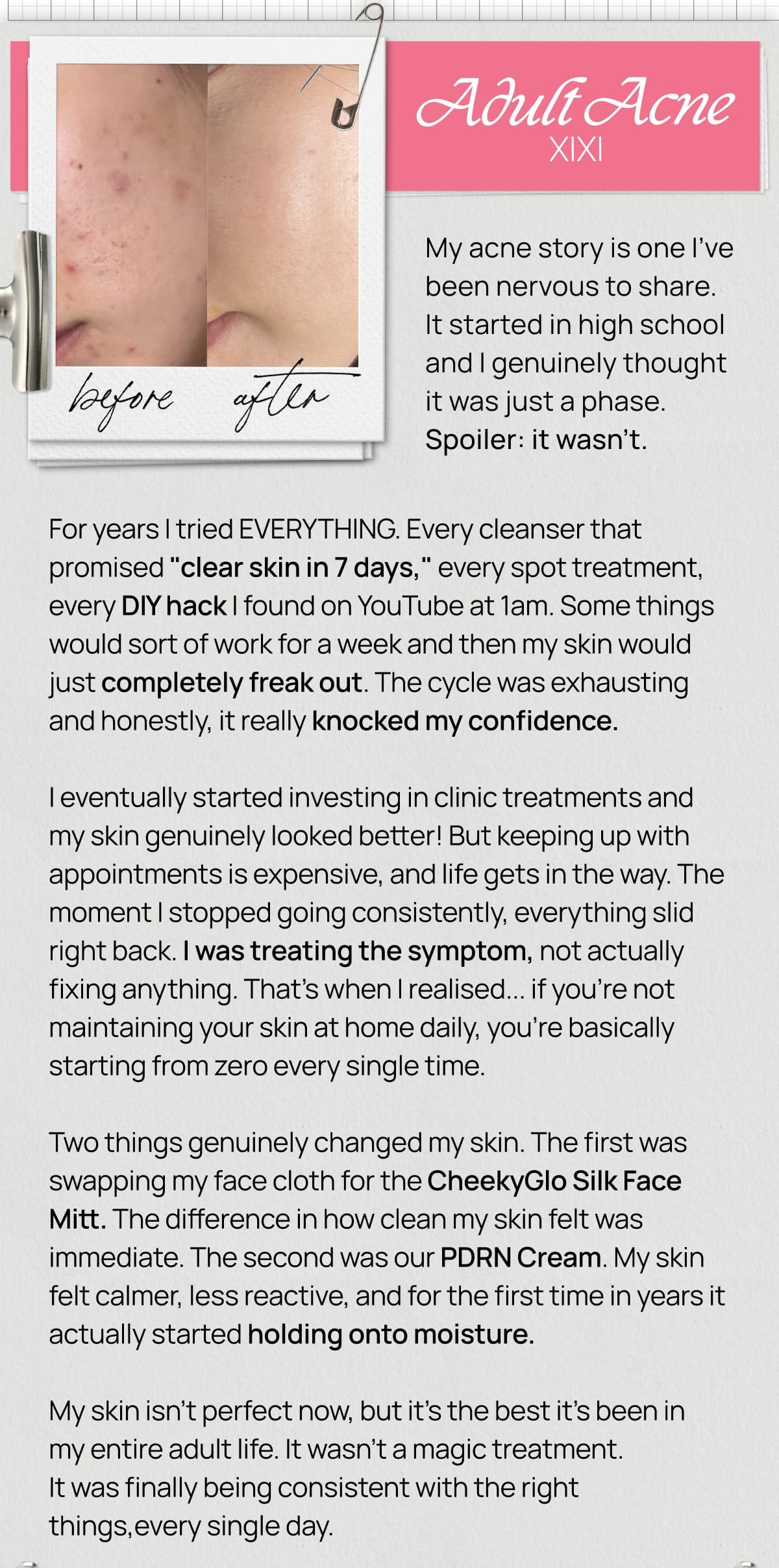Xixi's adult acne story with before and after photo and handwritten labels