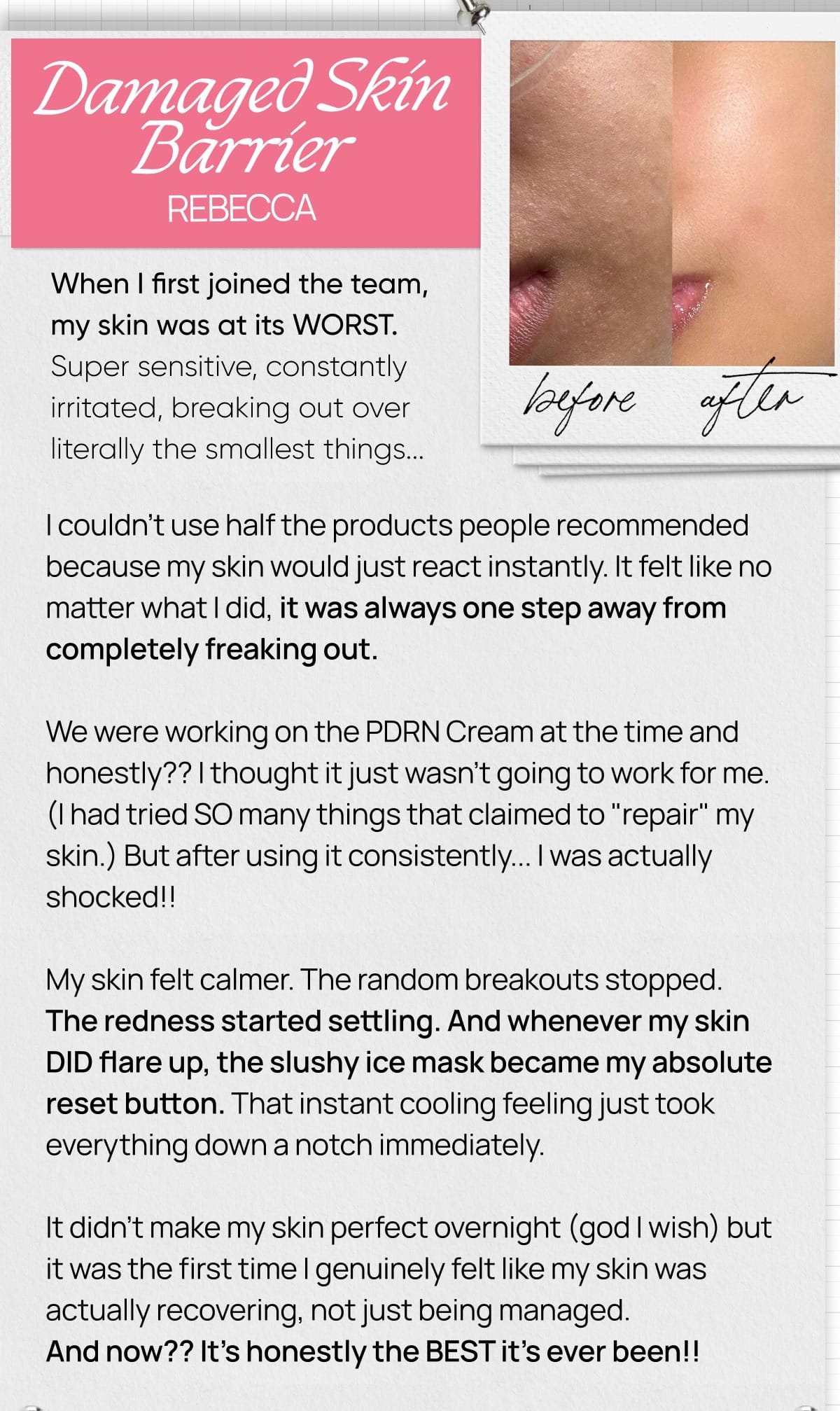 Rebecca's damaged skin barrier story with before and after close-up skin photos