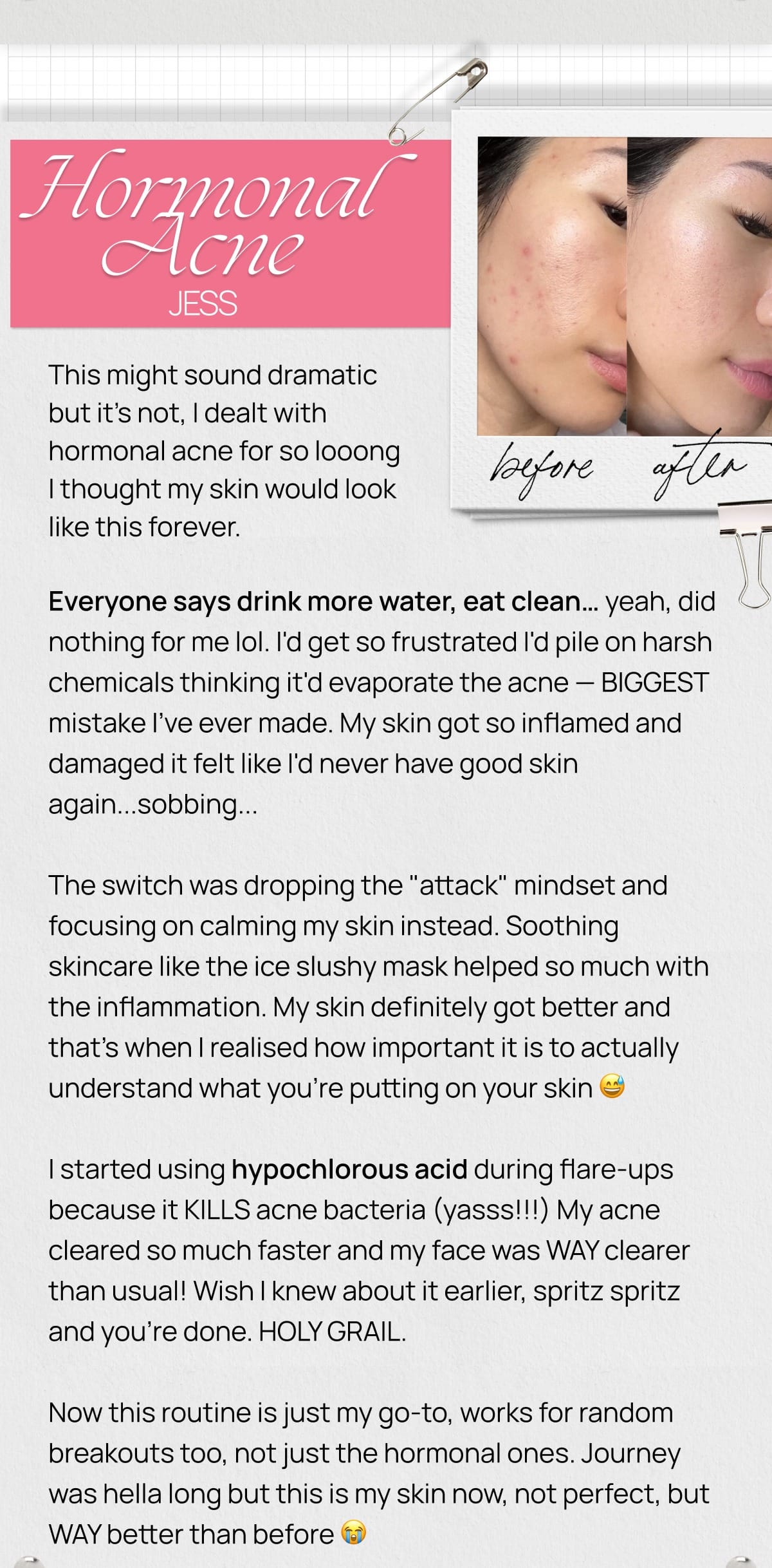 Jess's hormonal acne story with before and after photo showing clearer skin