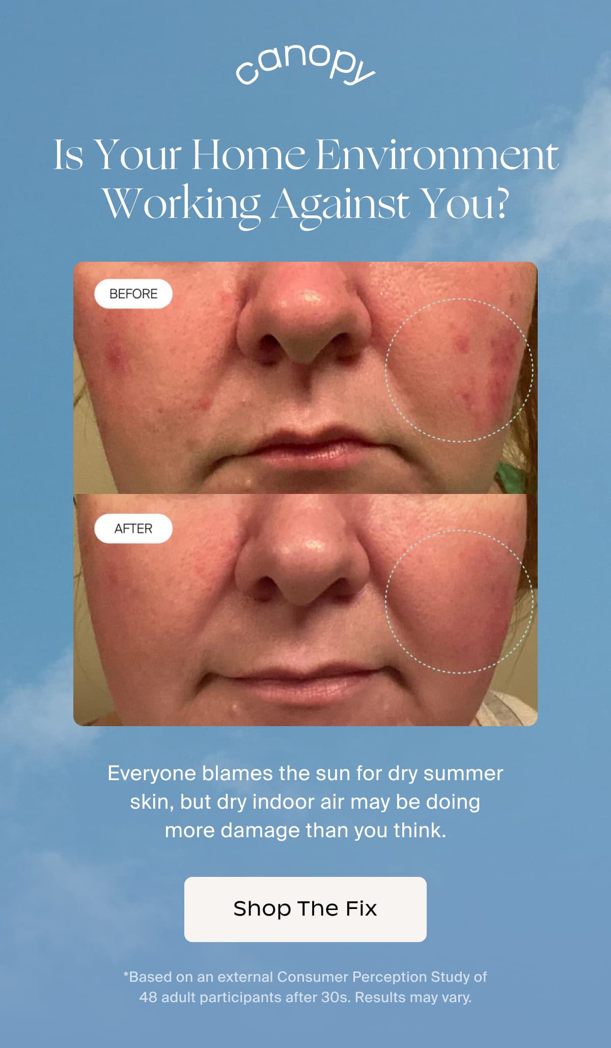 Canopy | Is Your Home Environment Working Against You? | Everyone blames the sun for dry summer skin, but dry indoor air may be doing more damage than you think. | Shop The Fix | *Based on an external Consumer Perception Study of 48 adult participants after 30s. Results may vary.