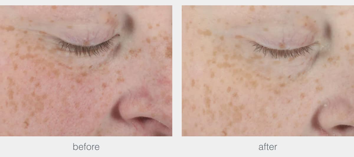 biolumin-c heat ageing protector spf50