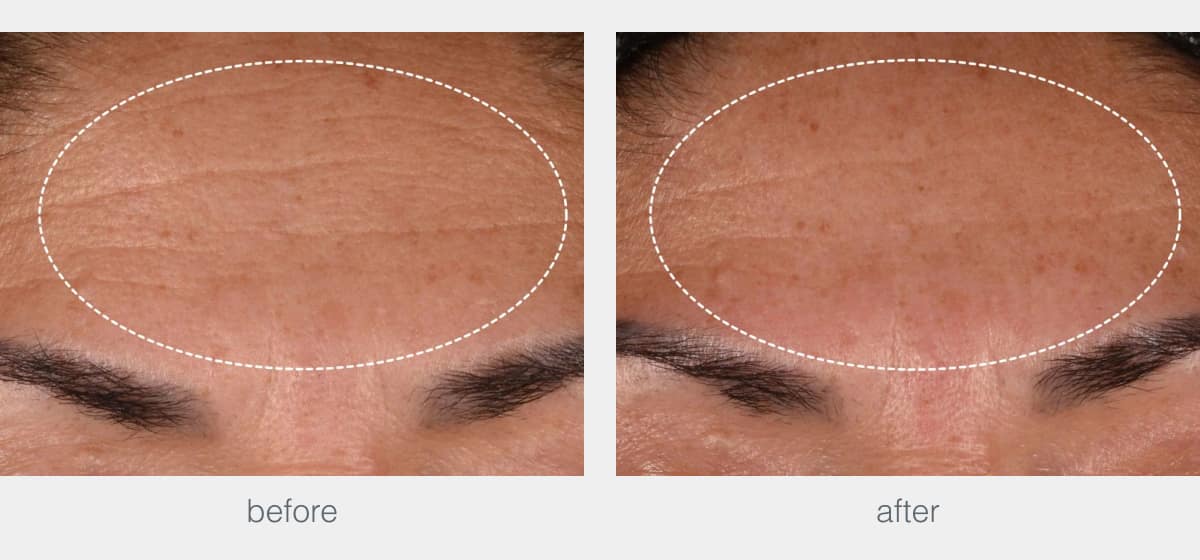 dynamic skin recovery spf50