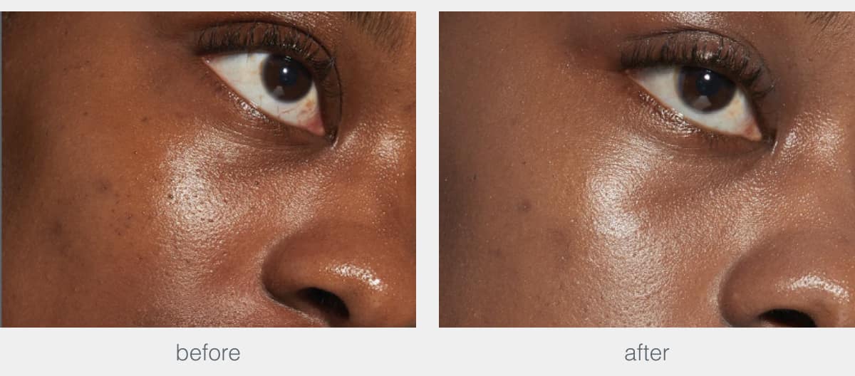 porescreen spf40