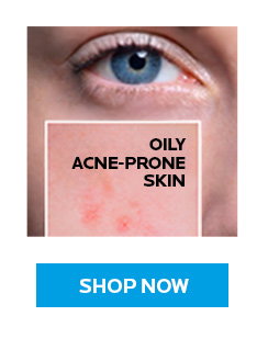 Oily Acne-Prone Skin