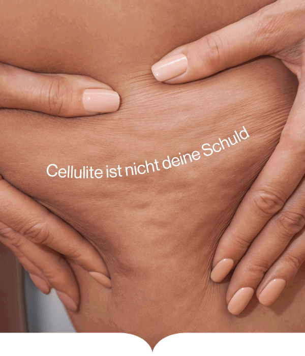 Cellulite ist nicht deine Schuld