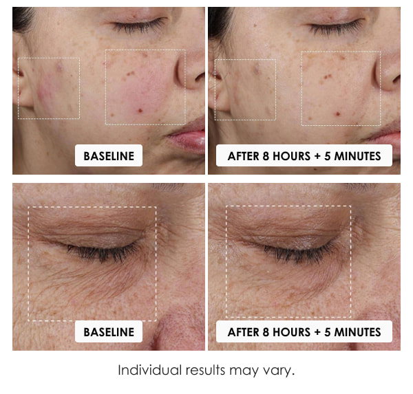 Obagi SuzanObagiMD Moisture Restore Test Result