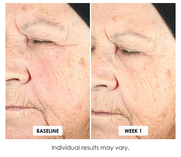 Obagi NU-GEN NAD+ Cellular Renewal Face Serum Test Result