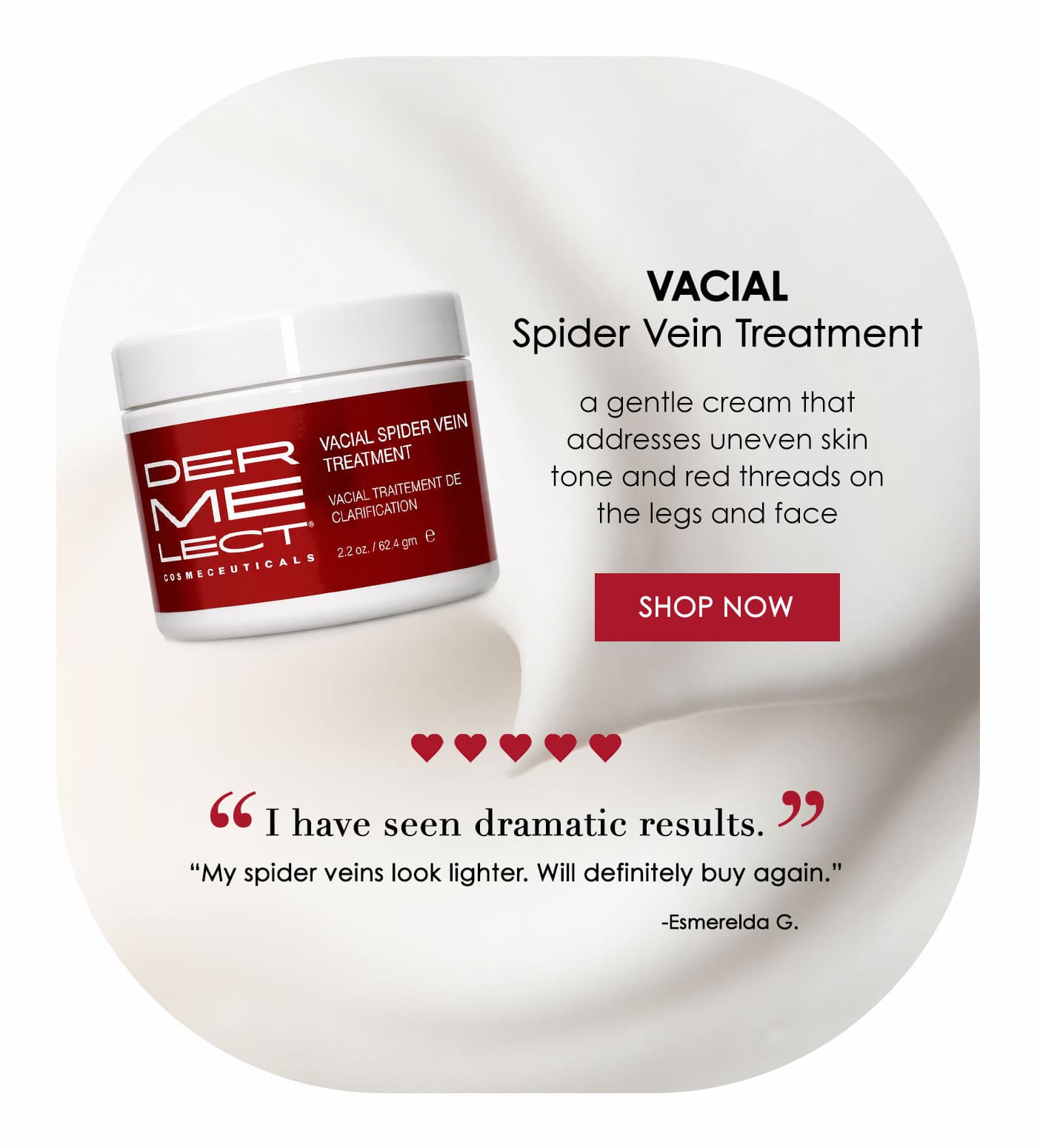 Vacial Spider Vein Treatment