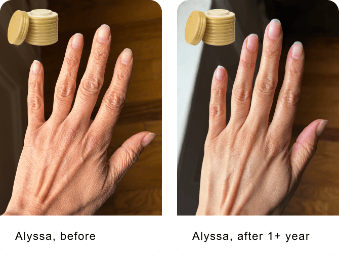 Alyssa, before / Alyssa, after 1+ year