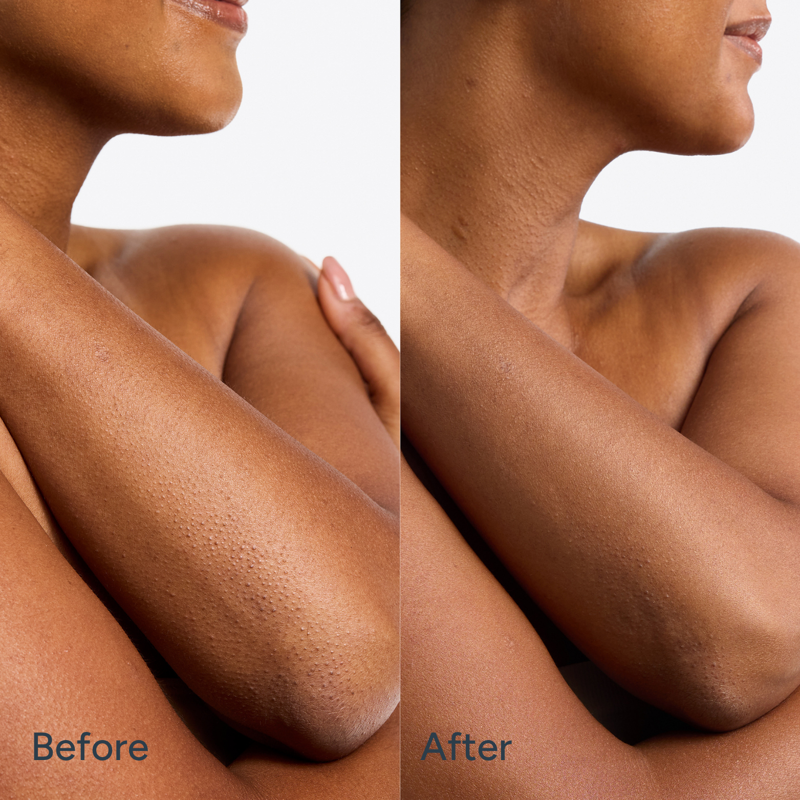 See the difference with our best-selling Transforming Body Lotion, developed with dermatologists to visibly