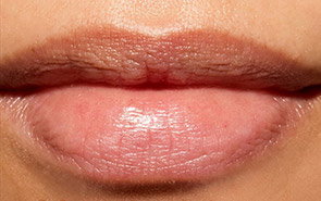 Close-up of the same lips looking smoother, plumper, and visibly more hydrated