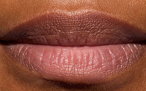 Close-up of lips with dry texture, fine lines, and a dull appearance