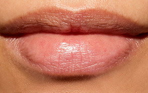 Close-up of lips showing dryness, fine lines, and uneven texture