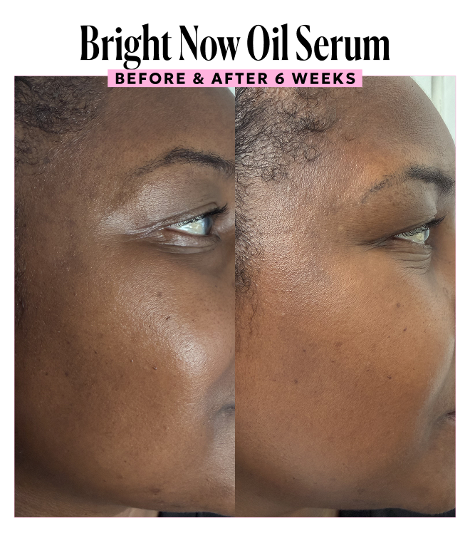 Experience Bright Now Oil Serum results in 6 weeks.