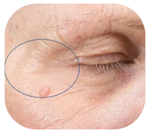 Same woman with improved tightness around eye area after 9 weeks of using Echelon Skin Science