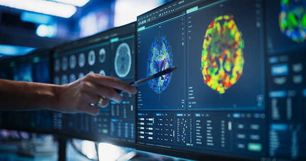 A close-up of multiple computer monitors showing brain scans. A hand is visible holding a pen pointing to one of the scans.