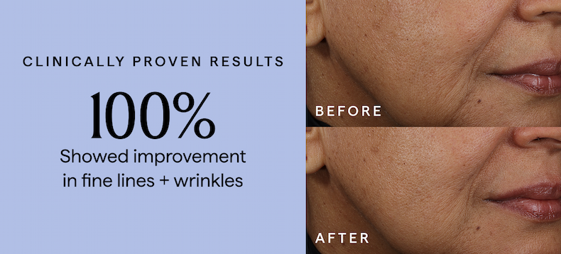 100% showed improvement in fine lines + wrinkles