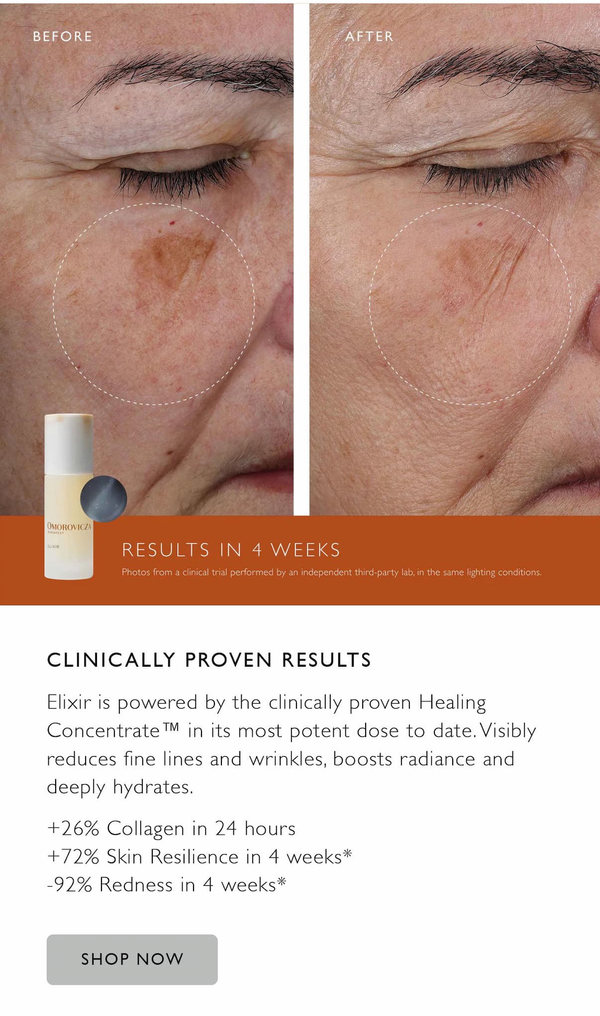 Clinically proven results