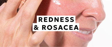 Redness & Rosacea