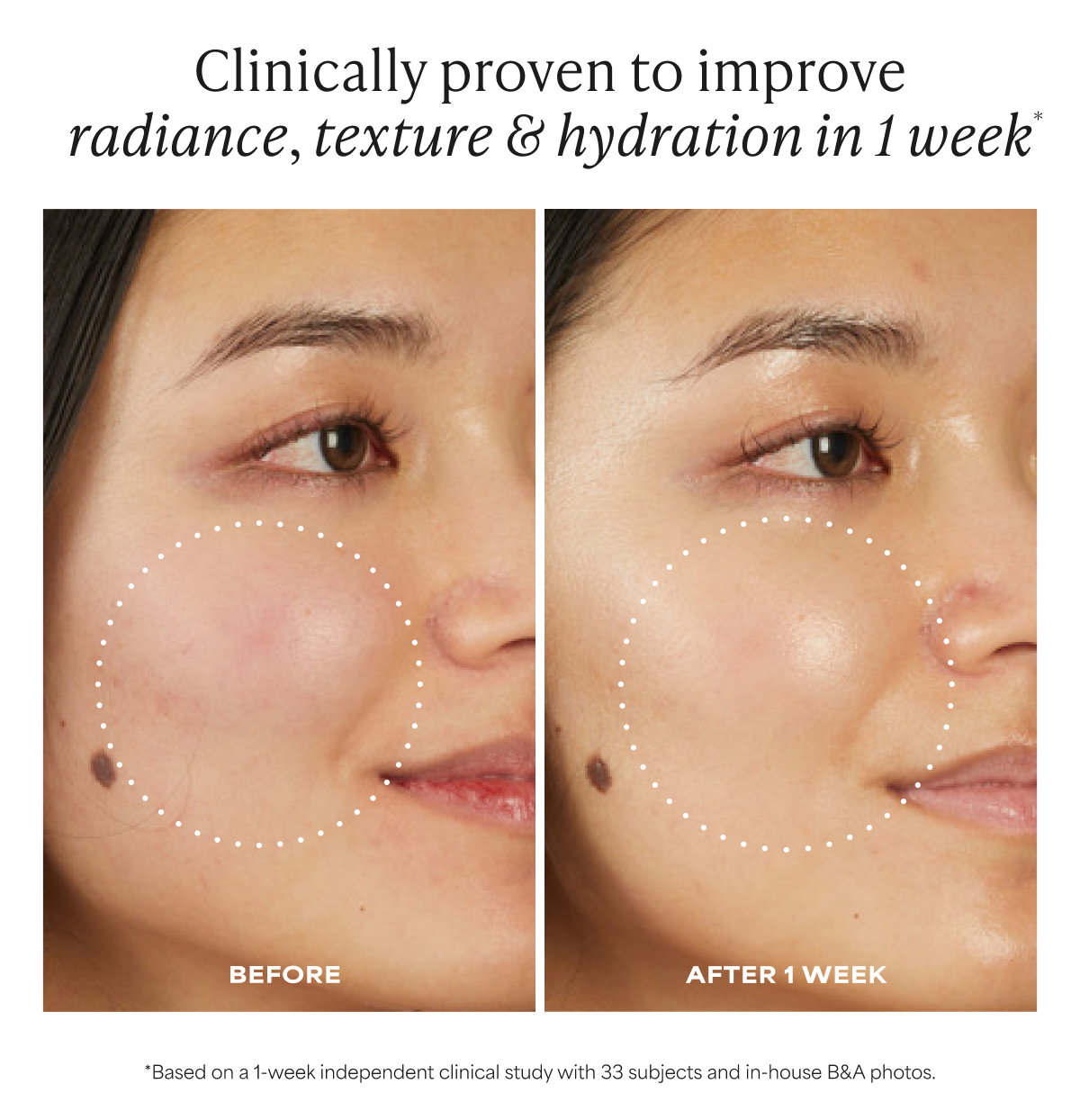 Clinically Proven To Improve Radiance, Texture & Hydration*