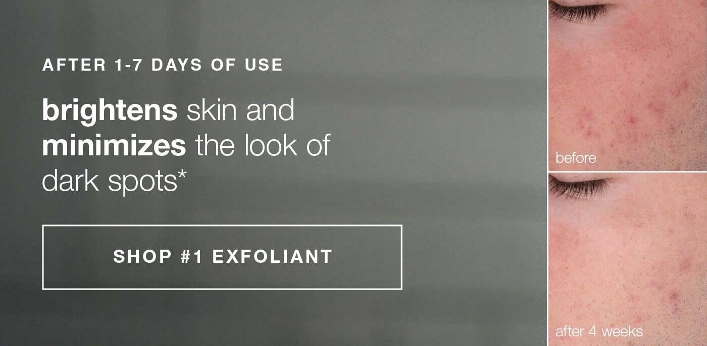 after 1-7 days of use | brightens skin and minimizes the look of dark spots* | SHOP #1 EXFOLIIANT | before | after 4 weeks