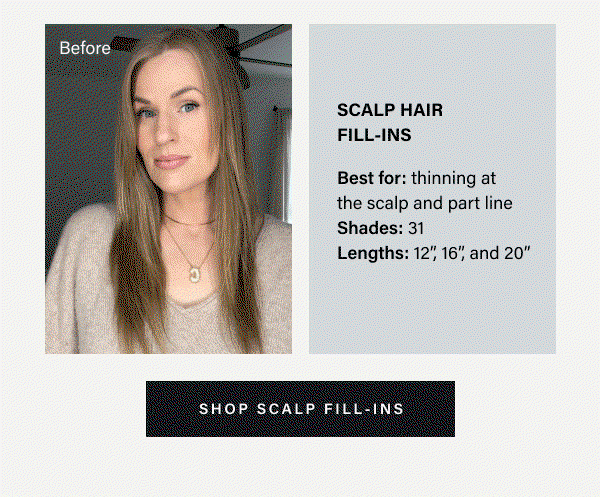 shop scalp fill-ins 