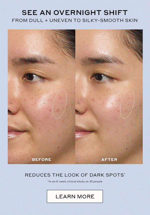 SEE OVERNIGHT SHIFT FROM DULL + UNEVEN TO SILY-SMOOTH SKIN