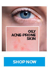 Oily Acne-Prone Skin