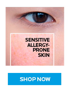 Sensitive Allergy Prone Skin