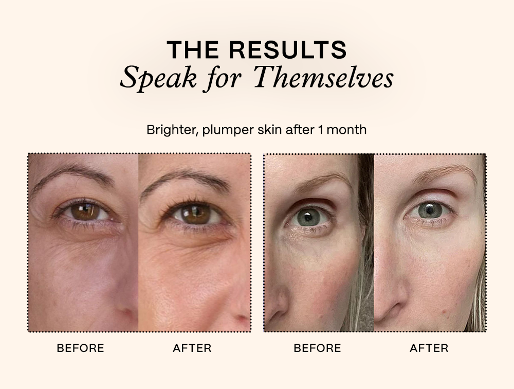 The Results Speak for Themselves | Brighter, plumper skin after 1 month - Shop Now