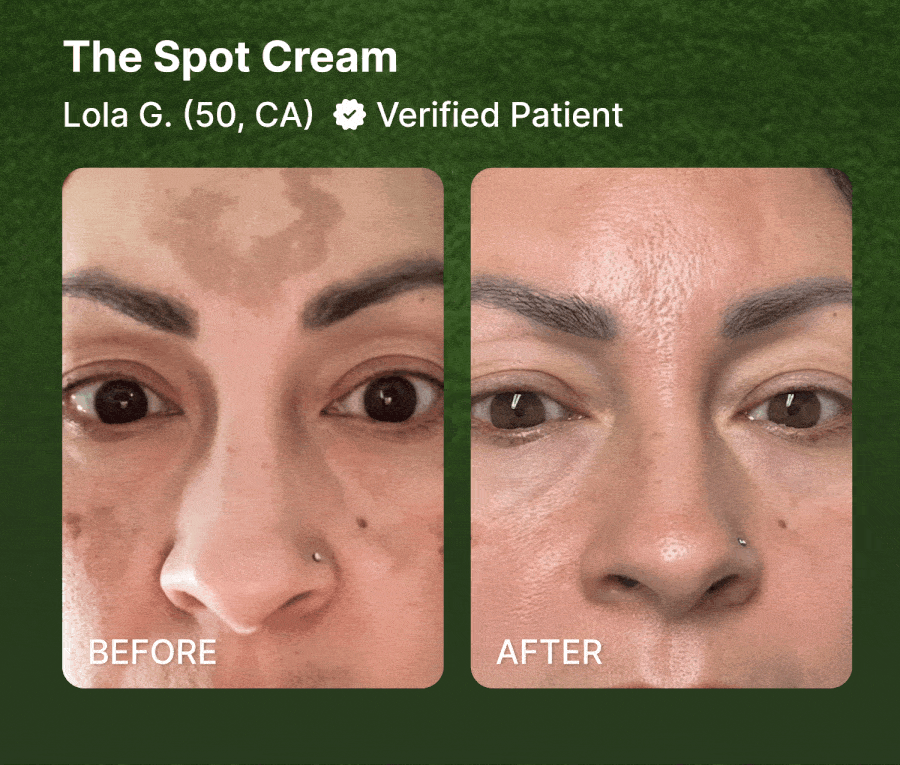 Last Call for 30% OFF All Prescription Treatments. Use Code: STARS30. Ends Tonight.