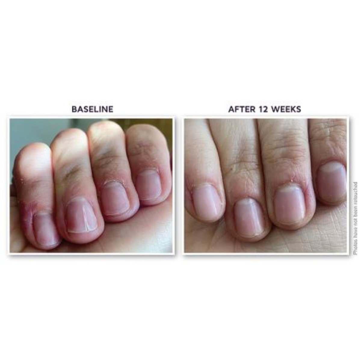 Nail Serum