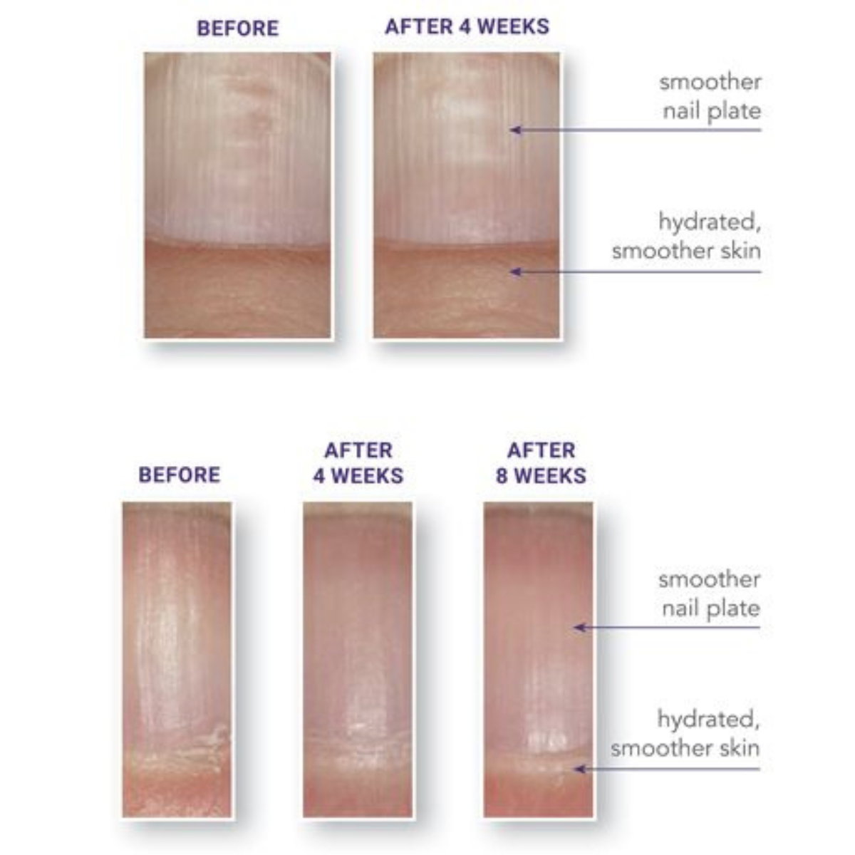 Nail Before After