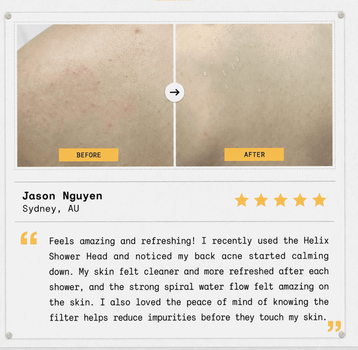 Before and after skin photos showing improvement with 5-star customer review from Jason Nguyen