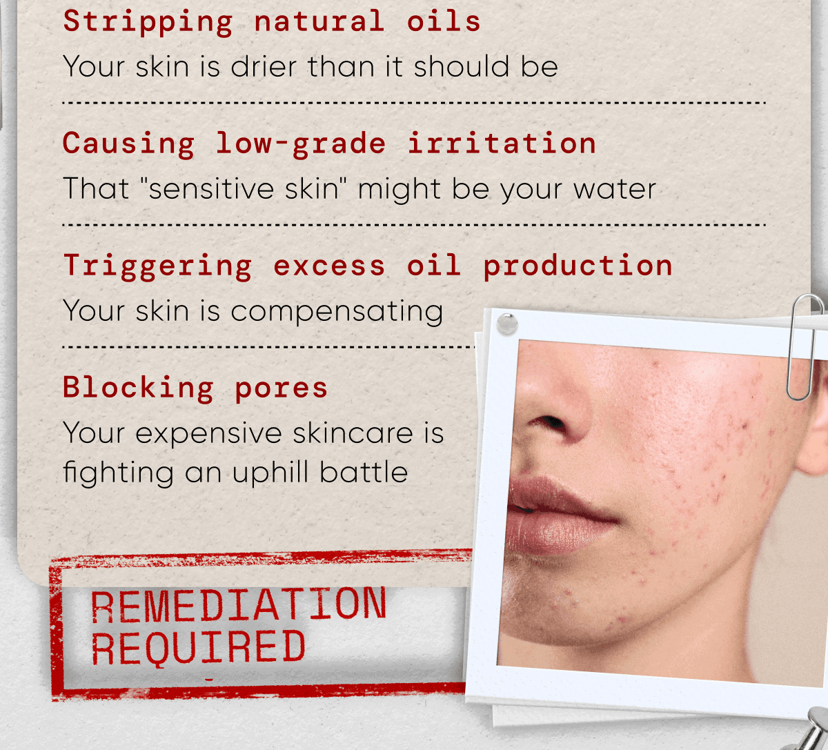 List of water quality issues including stripping oils, irritation, excess oil production, and blocked pores