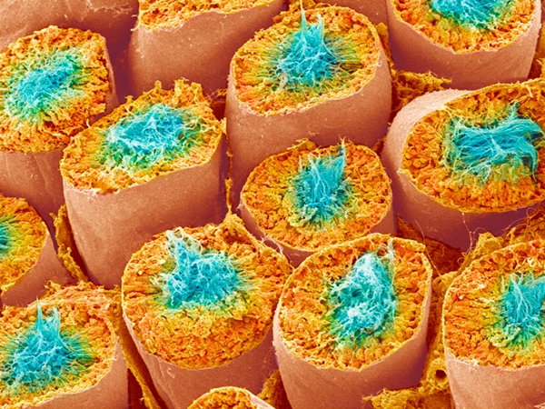 A coloured scanning electron micrograph of a transverse section of seminiferous tubules, parts of testicular tissue that produce sperm. The tubes are artificially coloured as a ring of orange around a turquoise centre.