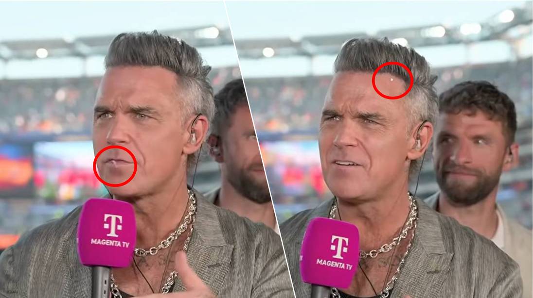 KIJK. Robbie Williams merkt tijdens interview op WK-finale niet dat object uit zijn mond op zijn voorhoofd belandt