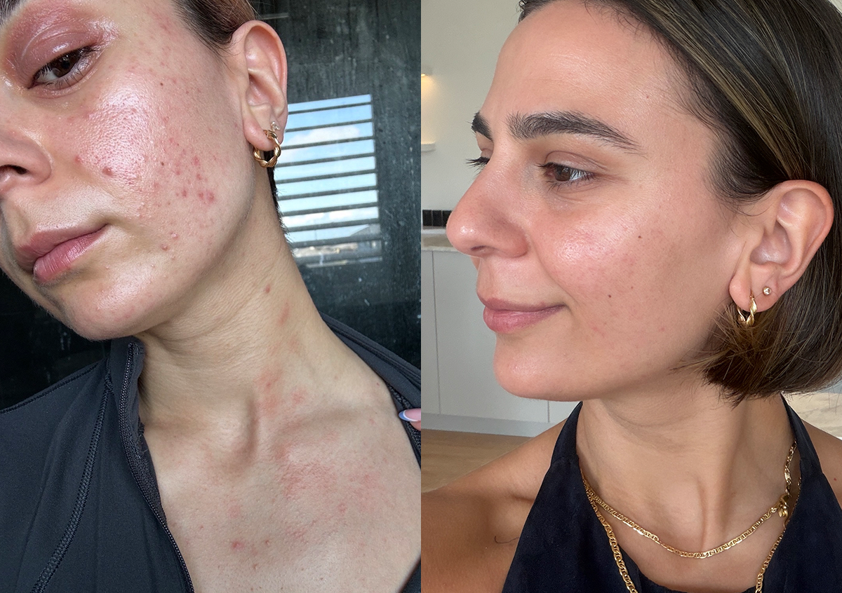 Dominique's Radiant Results