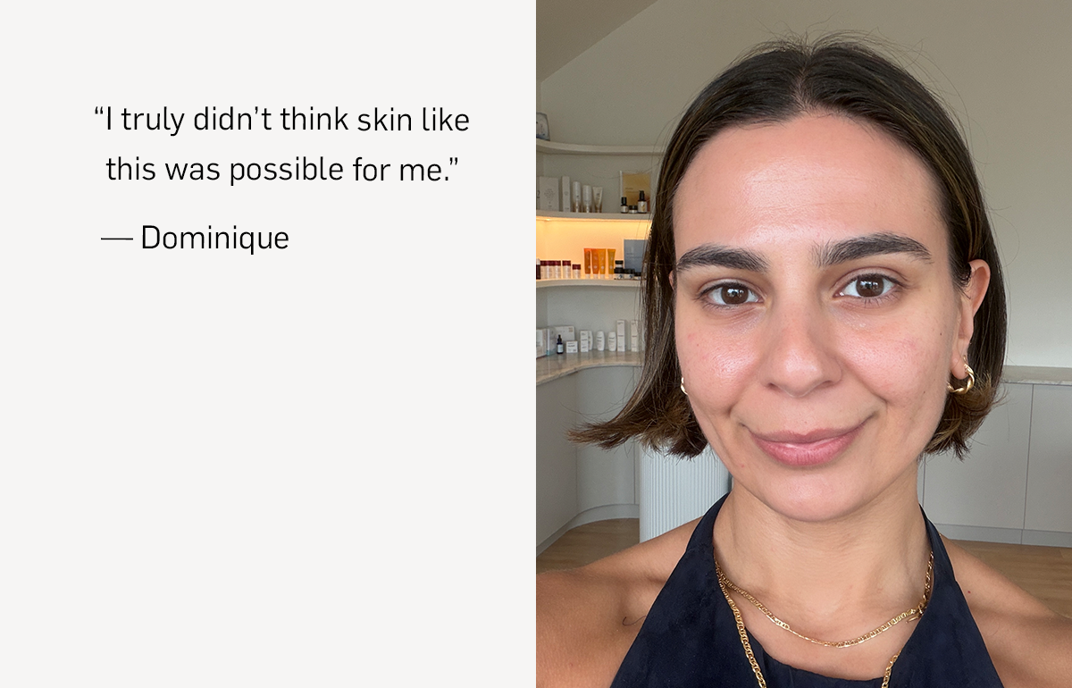 Dominique's Radiant Results