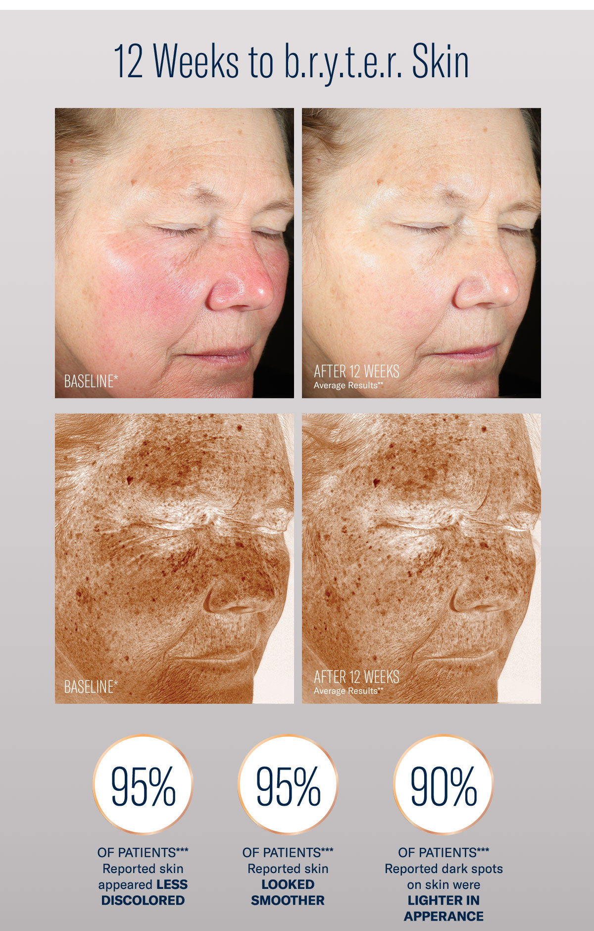 12 Weeks to bryter Skin