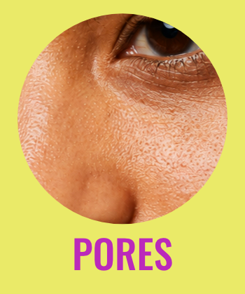 Pores